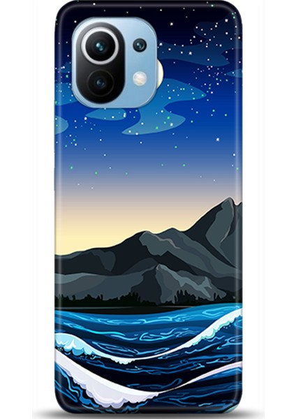 Xiaomi Mi 11 Kılıf Hd Baskılı Kılıf - Followed Institution 0581