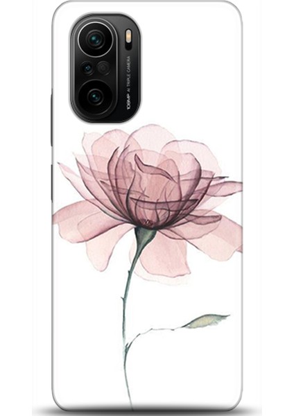 Xiaomi Mi 11i Kılıf Hd Baskılı Kılıf - Followed Institution 0309