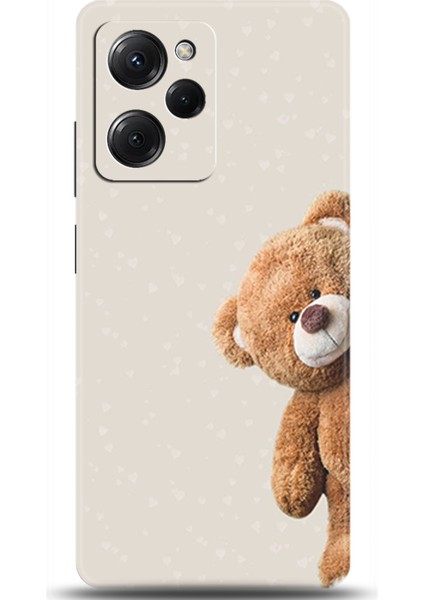 Xiaomi Poco X5 Pro Kılıf Hd Baskılı Kılıf - Followed Institution 0005