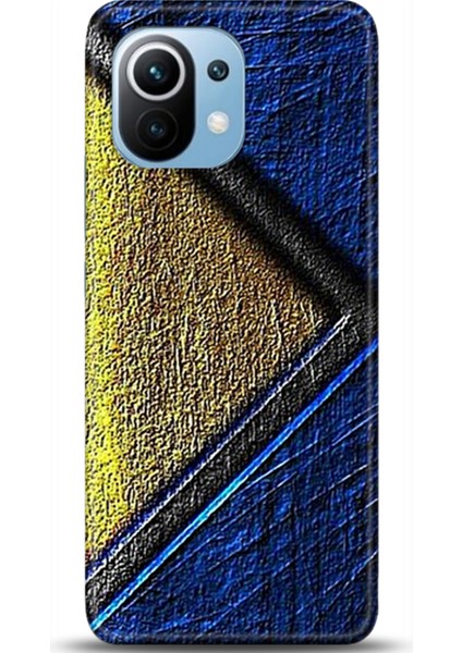Xiaomi Mi 11 Kılıf Hd Baskılı Kılıf - Followed Institution 0586