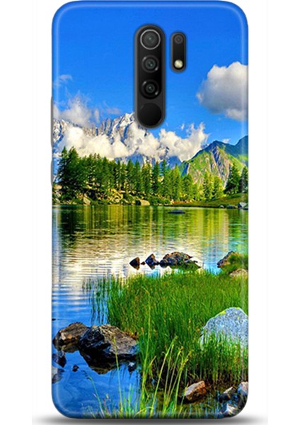 Xiaomi Redmi 9 Kılıf Hd Baskılı Kılıf - Followed Institution 0133