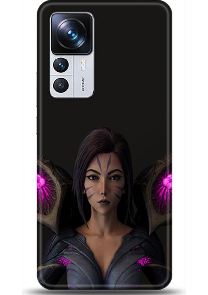 Xiaomi Mi 12T Kılıf Hd Baskılı Kılıf - Followed Institution 0108