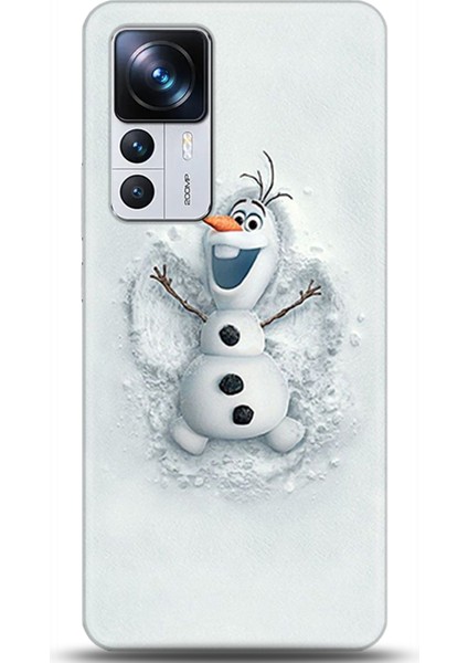 Xiaomi Mi 12T Pro Kılıf Hd Baskılı Kılıf - Followed Institution 0368