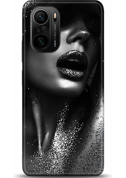 Xiaomi Mi 11i Kılıf Hd Baskılı Kılıf - Followed Institution 0338