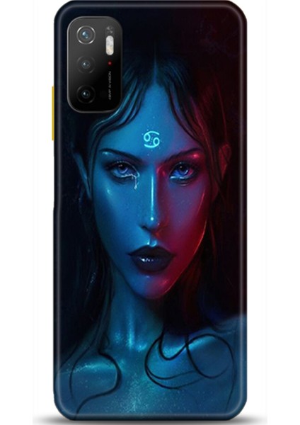 Xiaomi Poco M3 Pro Kılıf Hd Baskılı Kılıf - Followed Institution 0388