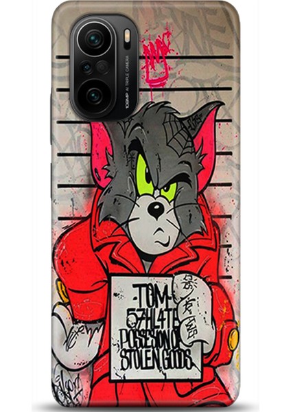 Xiaomi Mi 11i Kılıf Hd Baskılı Kılıf - Followed Institution 0519