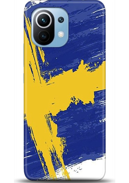 Xiaomi Mi 11 Kılıf Hd Baskılı Kılıf - Followed Institution 0545