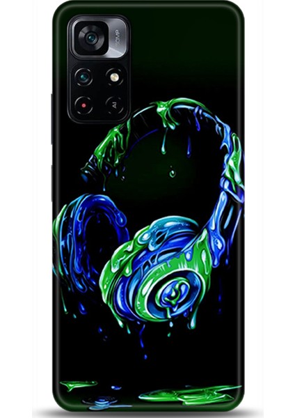 Xiaomi Poco M4 Pro 5g Kılıf Hd Baskılı Kılıf - Followed Institution 0455