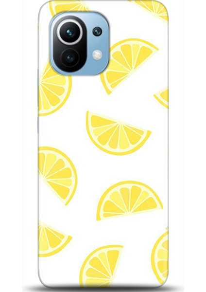 Xiaomi Mi 11 Kılıf Hd Baskılı Kılıf - Followed Institution 0105