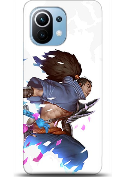 Xiaomi Mi 11 Kılıf Hd Baskılı Kılıf - Followed Institution 0122