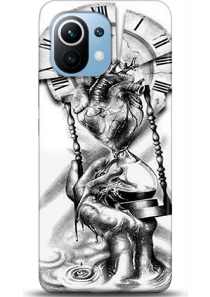 Xiaomi Mi 11 Kılıf Hd Baskılı Kılıf - Followed Institution 0232