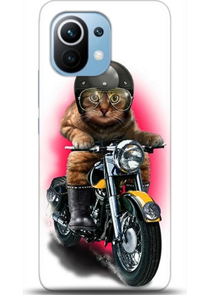 Xiaomi Mi 11 Kılıf Hd Baskılı Kılıf - Followed Institution 0241