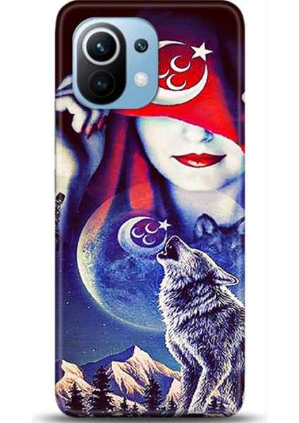 Xiaomi Mi 11 Kılıf Hd Baskılı Kılıf - Followed Institution 0285