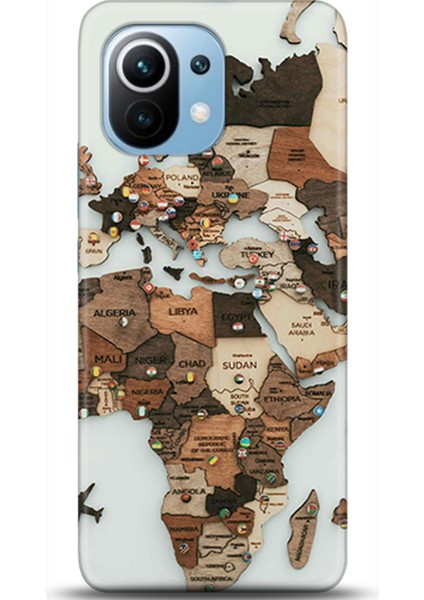 Xiaomi Mi 11 Kılıf Hd Baskılı Kılıf - Followed Institution 0457