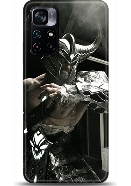 Xiaomi Poco M4 Pro 5g Kılıf Hd Baskılı Kılıf - Followed Institution 0328