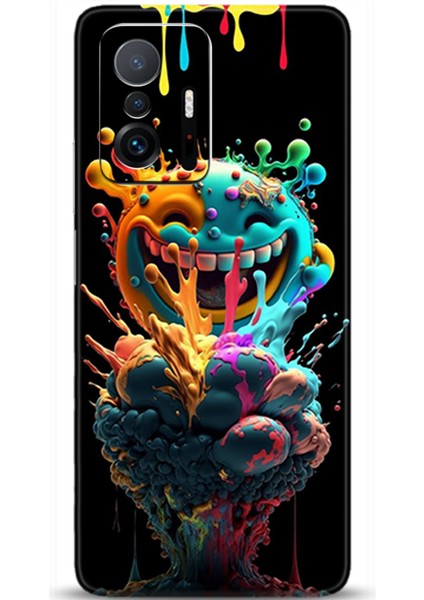 Xiaomi Mi 11T Kılıf Hd Baskılı Kılıf - Followed Institution 0617