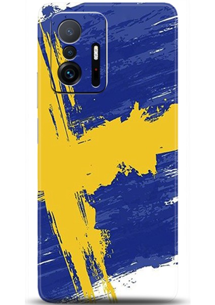 Xiaomi Mi 11T Kılıf Hd Baskılı Kılıf - Followed Institution 0545