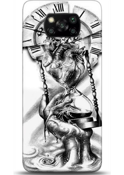 Xiaomi Poco X3 Pro Kılıf Hd Baskılı Kılıf - Followed Institution 0232