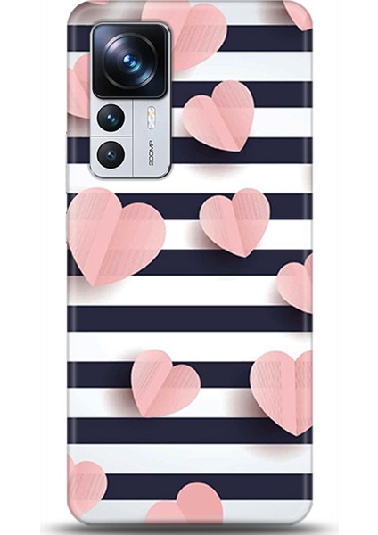 Xiaomi Mi 12T Kılıf Hd Baskılı Kılıf - Followed Institution 0682