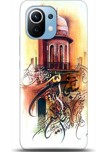 Xiaomi Mi 11 Kılıf Hd Baskılı Kılıf - Followed Institution 0146