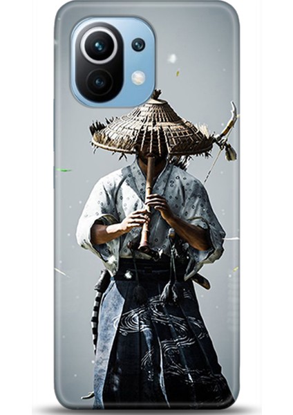 Xiaomi Mi 11 Kılıf Hd Baskılı Kılıf - Followed Institution 0361