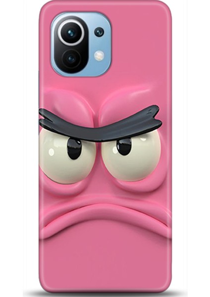 Xiaomi Mi 11 Kılıf Hd Baskılı Kılıf - Followed Institution 0053