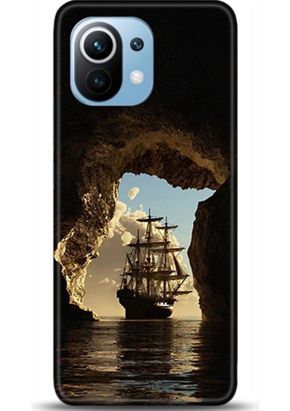 Xiaomi Mi 11 Kılıf Hd Baskılı Kılıf - Followed Institution 0274