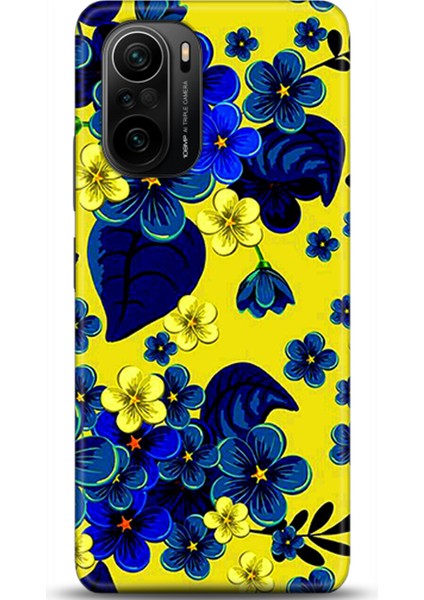 Xiaomi Mi 11i Kılıf Hd Baskılı Kılıf - Followed Institution 0477