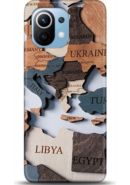 Xiaomi Mi 11 Kılıf Hd Baskılı Kılıf - Followed Institution 0460