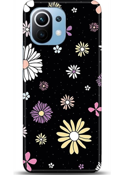 Xiaomi Mi 11 Kılıf Hd Baskılı Kılıf - Followed Institution 0490