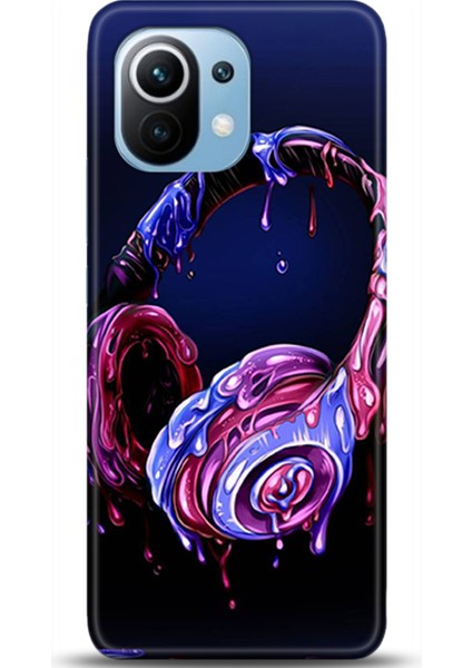 Xiaomi Mi 11 Kılıf Hd Baskılı Kılıf - Followed Institution 0453