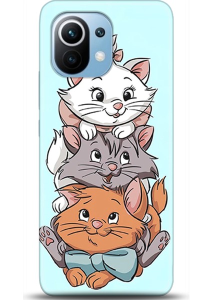 Xiaomi Mi 11 Kılıf Hd Baskılı Kılıf - Followed Institution 0459