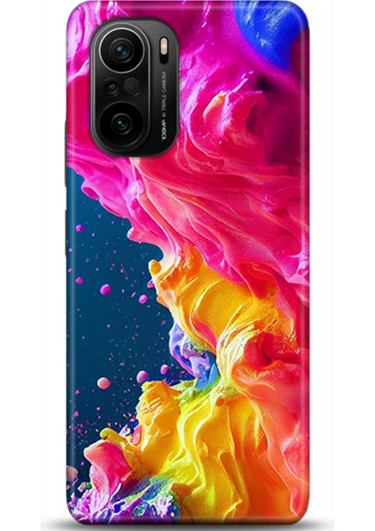 Xiaomi Mi 11i Kılıf Hd Baskılı Kılıf - Followed Institution 0599