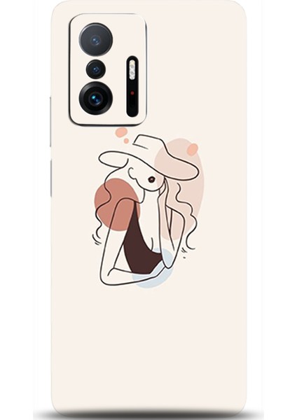 Xiaomi Mi 11T Kılıf Hd Baskılı Kılıf - Followed Institution 0380
