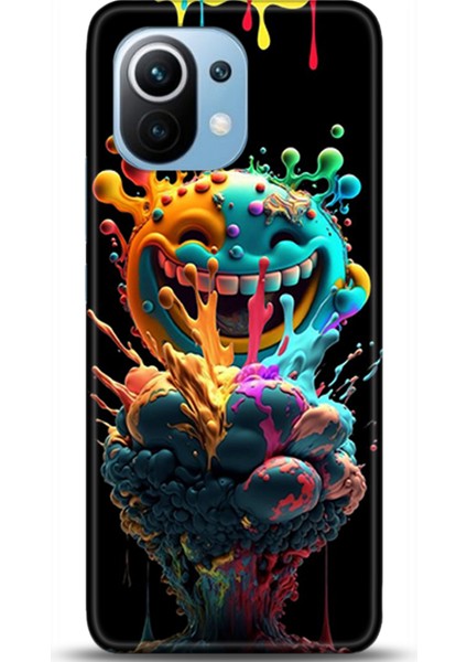 Xiaomi Mi 11 Kılıf Hd Baskılı Kılıf - Followed Institution 0617