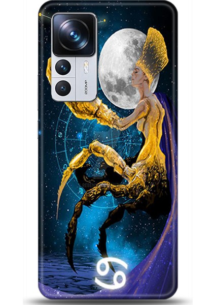 Xiaomi Mi 12T Kılıf Hd Baskılı Kılıf - Followed Institution 0106