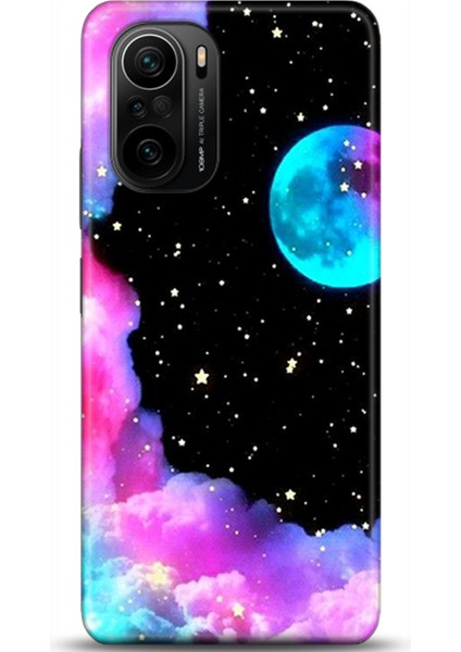 Xiaomi Mi 11i Kılıf Hd Baskılı Kılıf - Followed Institution 0067