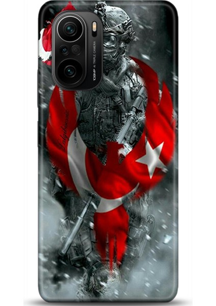 Xiaomi Mi 11i Kılıf Hd Baskılı Kılıf - Followed Institution 0231