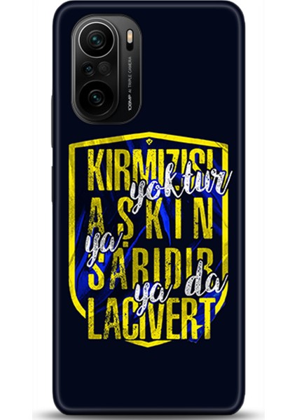 Xiaomi Mi 11i Kılıf Hd Baskılı Kılıf - Followed Institution 0551