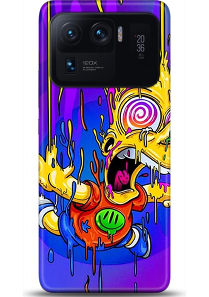 Xiaomi Mi 11 Ultra Kılıf Hd Baskılı Kılıf - Followed Institution 0158