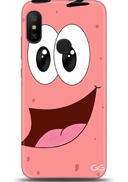 Xiaomi Mi A2 Lite Kılıf Hd Baskılı Kılıf - Followed Institution 0027