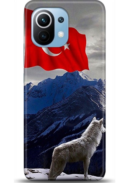 Xiaomi Mi 11 Kılıf Hd Baskılı Kılıf - Followed Institution 0536