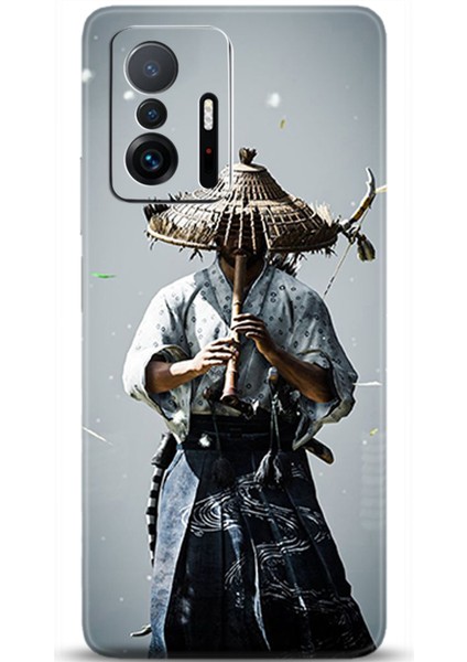 Xiaomi Mi 11T Pro Kılıf Hd Baskılı Kılıf - Followed Institution 0361