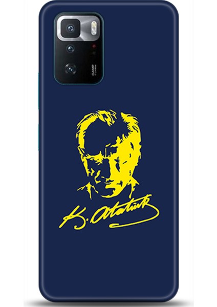 Xiaomi Poco X3 Gt Kılıf Hd Baskılı Kılıf - Followed Institution 0548