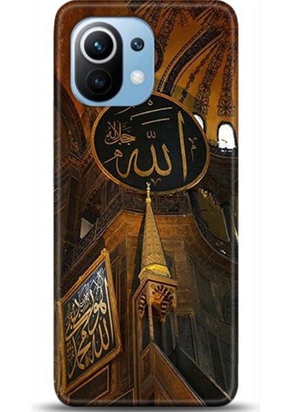 Xiaomi Mi 11 Kılıf Hd Baskılı Kılıf - Followed Institution 0092