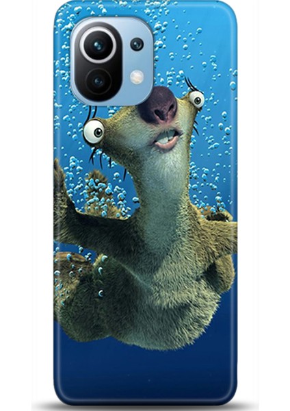 Xiaomi Mi 11 Kılıf Hd Baskılı Kılıf - Followed Institution 0124