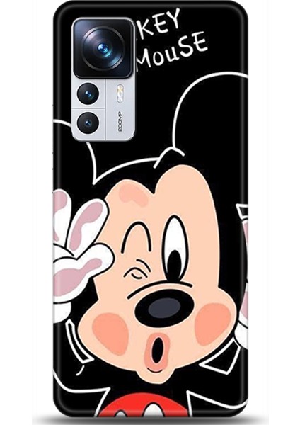 Xiaomi Mi 12T Pro Kılıf Hd Baskılı Kılıf - Followed Institution 0020