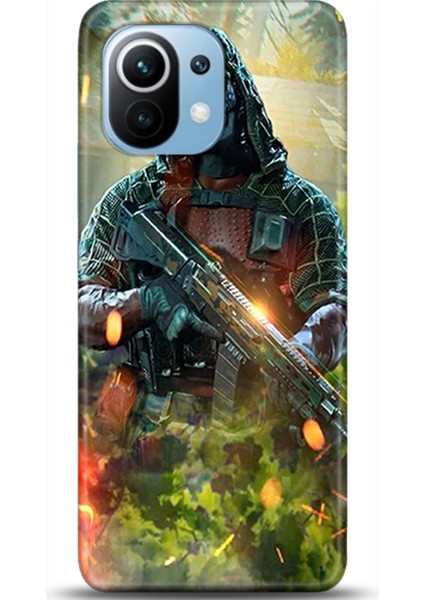 Xiaomi Mi 11 Kılıf Hd Baskılı Kılıf - Followed Institution 0138