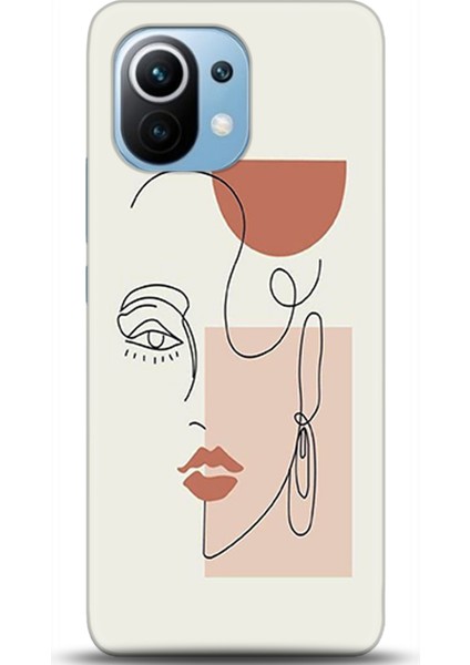Xiaomi Mi 11 Kılıf Hd Baskılı Kılıf - Followed Institution 0172
