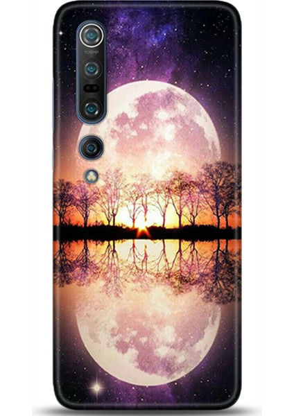 Xiaomi Mi 10 Pro Kılıf Hd Baskılı Kılıf - Followed Institution 0147